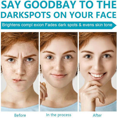 YAWI dark spot brightening cream(50 g)
