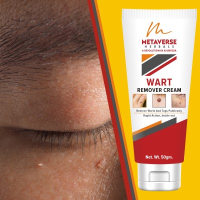 Metaverse Wart Cure Fast Formula Wart Silence Therapeutic Cream(50 g)