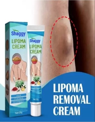 GROOVS Lipoma removal cream lump remover neck fat shoulder fat body(20 g)