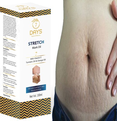 7 Days Stretch Marks Oil to Minimize Stretch Marks & Even Out Skin Tone(100 ml)