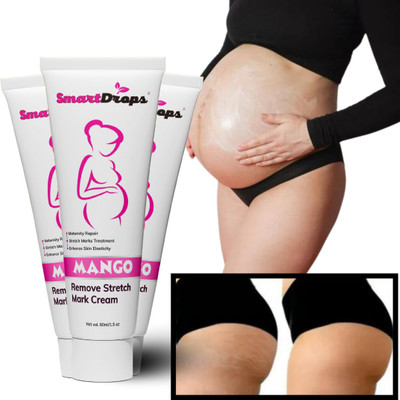 smartdrops Deeply Nourishing Stretch Mark Remover Cream(180 ml)