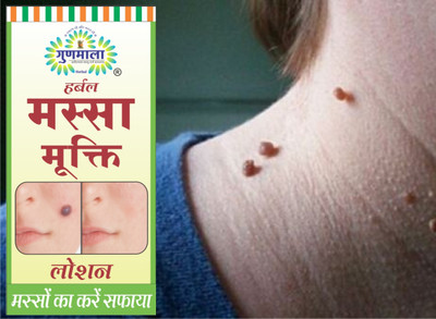 Gunmala Massa Nashak Lotion / Massa Mukti Lotion For Wart Remover - 5 Ml. Pack Of 1(5 ml)