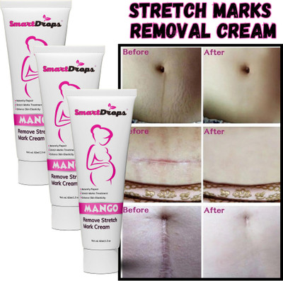 smartdrops Remove And Tube(180 ml)