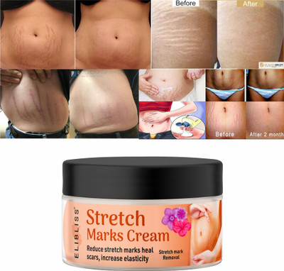 ELIBLISS Stretch Marks Cream to Help Minimize Stretch Marks & Even Out Skin Tone(50 g)