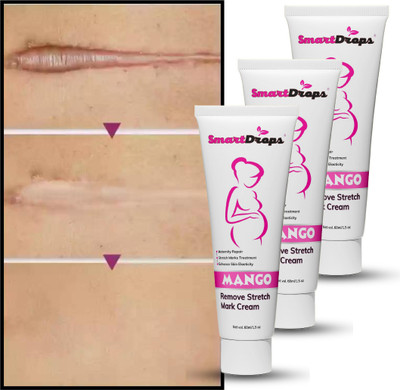 smartdrops Stretch Mark And Scars Repair and Removal Cream(180 ml)