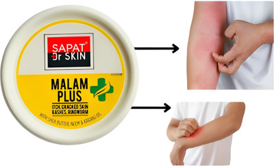 CK CREATION Sapat Malam Ointment For Fungal Infection Pack of 1(11 g)
