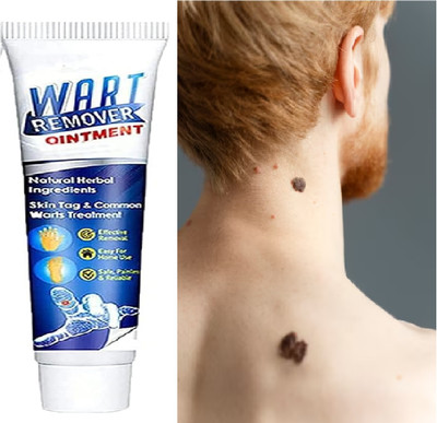 GULGLOW99 Wart Treatment Unique Cream Warts Remover Ointment Skin Tag Removal(100 g)
