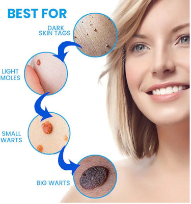 Emijun Hair Growth Spray Combo With Wart Remover Cream For Men And Women(2 Items in the set)