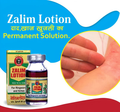 CK CREATION Lotion For Itching, Dryness and Best Fungal Infection LotionPack of 1(10 ml)