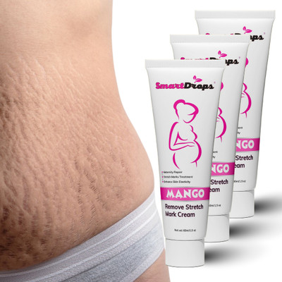 smartdrops Stretch Mark Cream For Remove Scars & Stretch Mark(180 ml)