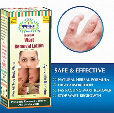 Gunmala Wart Removal Lotion / Wart Remover Cream For Body Massa & Neck Skintag -10 Ml.(10 ml)