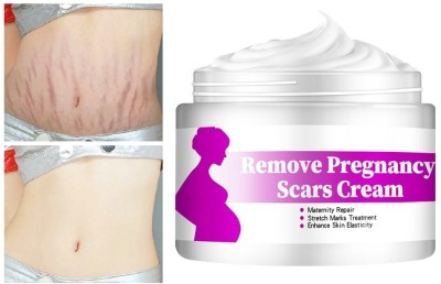 MYEONG Scar Cream Removal Cream Scars Essence Stretch Mark(50 g)