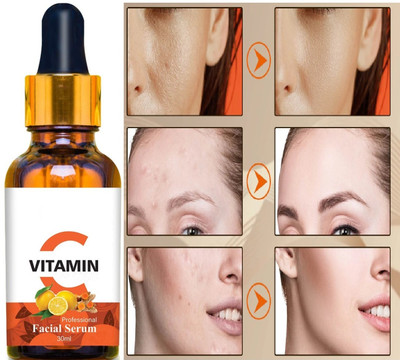 GFSU - GO FOR SOMETHING UNIQUE Vitamin C-Advance Radiance serum(30 ml)