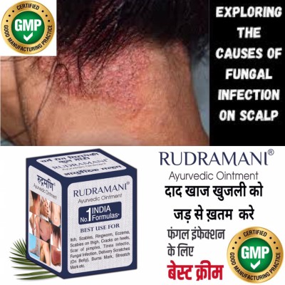 Rudramani Marham Malam For-Itching, Dad Khaj Khujli , Any Skin Infection, Skin Treatment .(25 g)