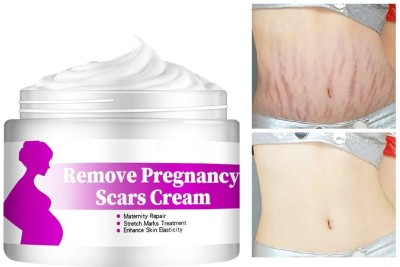 MYEONG Scars Essence Stretch Mark Scar Cream Removal Cream(50 g)