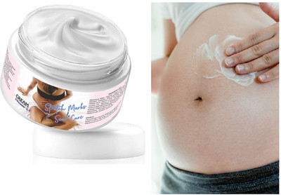 Latixmat Stretch Mark Removal Cream to Reduce Scars & Spots(50 g)