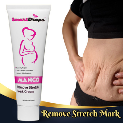 smartdrops Stretch Marks Cream to Reduce Stretch Marks & Scars(60 ml)
