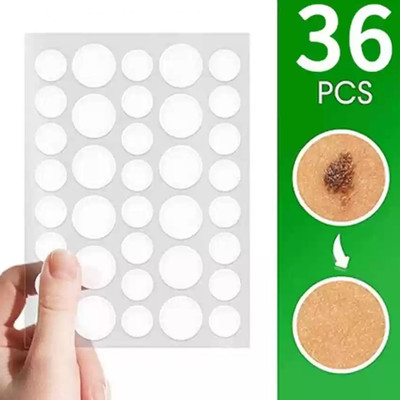 YuLif5 Acne Pimple Patch Hydrocolloid Waterproof Patches For Active Surface 36 patch(20 g)
