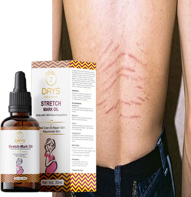 7 Days stretch marks oil cream after delivery stretch marks cream before delivery(30 ml)