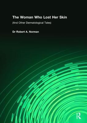 The Woman Who Lost Her Skin(English, Paperback, Norman Rob)