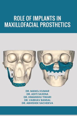 ROLE OF IMPLANTS IN MAXILLOFACIAL PROSTHETICS(Paperback, Dr. Manoj Kumar, Dr. Aditi Saxena ,Dr. Himanshu Tiwari, Dr. Vaibhav Bansal, Dr. Abhishek Sachdeva)