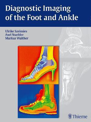 Diagnostic Imaging of the Foot and Ankle(English, Hardcover, unknown)