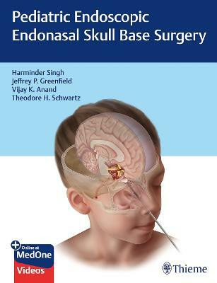 Pediatric Endoscopic Endonasal Skull Base Surgery(English, Mixed media product, Singh Harminder)