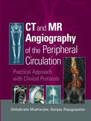 CT and MR Angiography of the Peripheral Circulation(English, Hardcover, unknown)