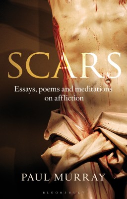 Scars(English, Paperback, Murray OP Paul Dr)