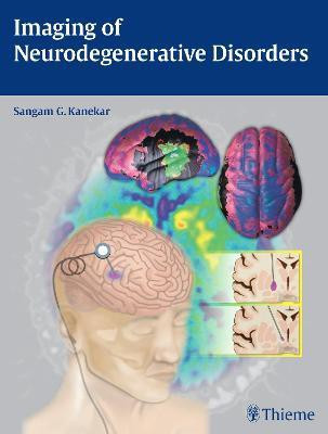 Imaging of Neurodegenerative Disorders(English, Hardcover, unknown)