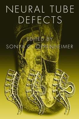 Neural Tube Defects(English, Electronic book text, unknown)