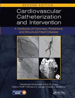 Cardiovascular Catheterization and Intervention(English, Paperback, unknown)