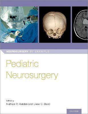 Pediatric Neurosurgery(English, Paperback, unknown)