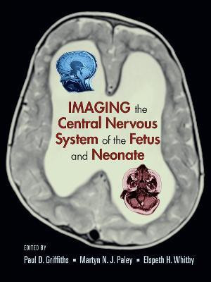 Imaging the Central Nervous System of the Fetus and Neonate(English, Hardcover, unknown)