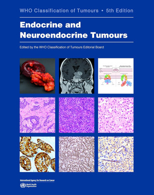 WHO Classification of Endocrine and Neuroendocrine Tumours 5th edition(English, Paperback, World Health Organization: International Agency for Research on Cancer)