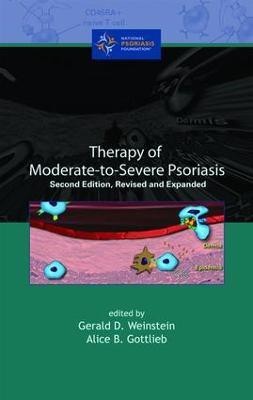 Therapy of Moderate-to-Severe-Psoriasis(English, Electronic book text, unknown)