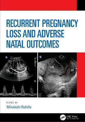 Recurrent Pregnancy Loss and Adverse Natal Outcomes(English, Hardcover, unknown)