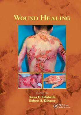 Wound Healing(English, Paperback, unknown)
