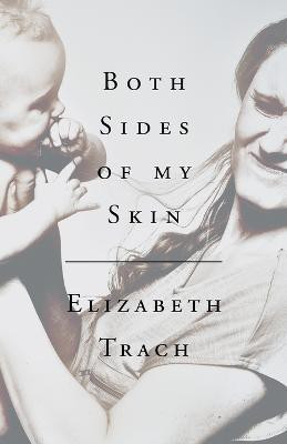 Both Sides of My Skin(English, Paperback, Trach Elizabeth)
