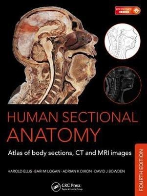 Human Sectional Anatomy(English, Electronic book text, Dixon Adrian K.)