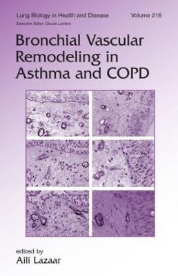 Bronchial Vascular Remodeling in Asthma and COPD(English, Hardcover, unknown)