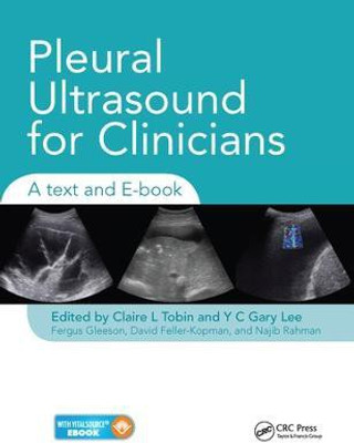 Pleural Ultrasound for Clinicians(English, Paperback, unknown)