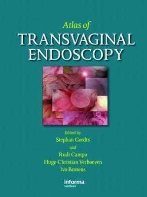Atlas of Transvaginal Endoscopy(English, Hardcover, unknown)