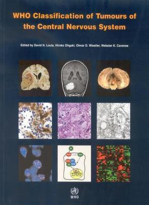 WHO Classification of Tumours of the Central Nervous System: WHO Classification of Tumours Volume 1(English, Paperback, International Agency for Research on Cancer W. K.)