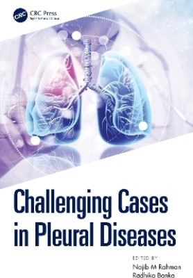 Challenging Cases in Pleural Diseases(English, Paperback, unknown)