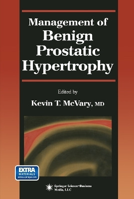 Management of Benign Prostatic Hypertrophy(English, Paperback, unknown)