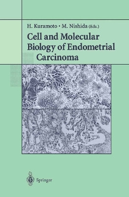 Cell and Molecular Biology of Endometrial Carcinoma(English, Paperback, unknown)