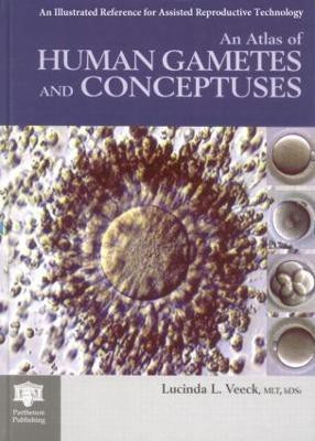 An Atlas of Human Gametes and Conceptuses(English, Hardcover, unknown)