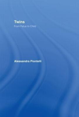 Twins - From Fetus to Child(English, Hardcover, unknown)