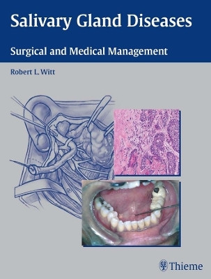 Salivary Gland Diseases(English, Electronic book text, unknown)
